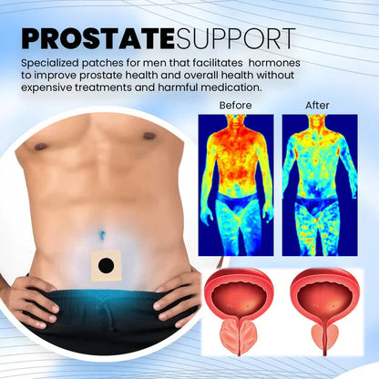 Seurico™  Prostate Treatment Patch