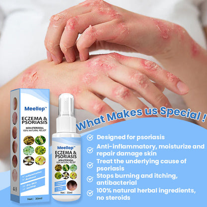 Meellop™ Herbal Psoriasis Relief Spray🌟