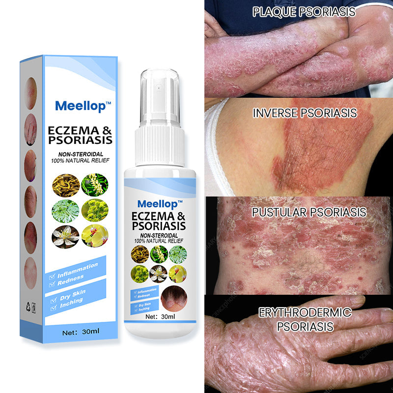 Meellop™ Herbal Psoriasis Relief Spray🌟