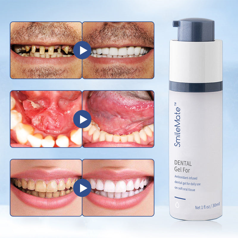 SmileMate™ Teeth Whitening Repair Regrowth Dental Gel