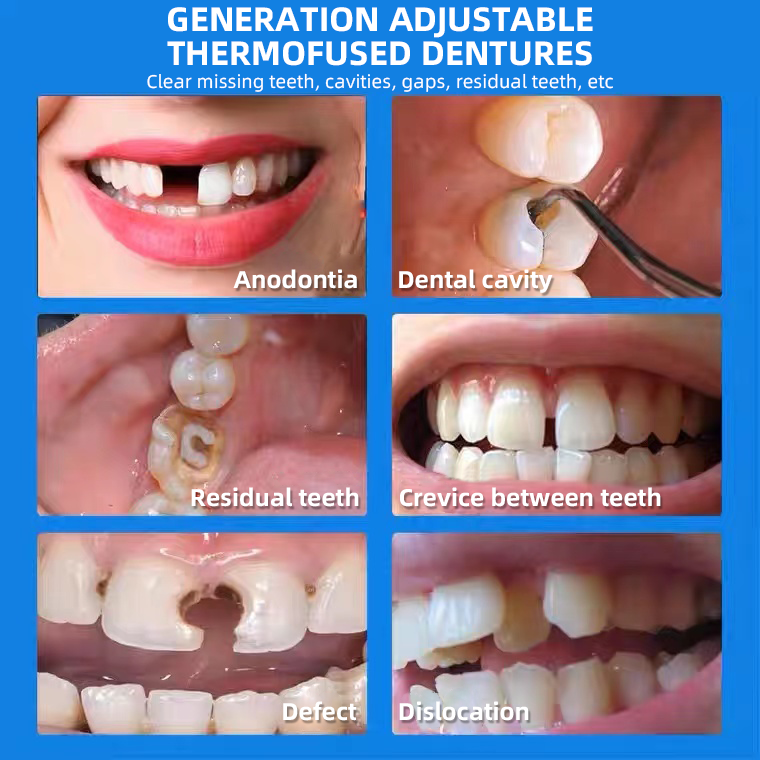 Seurico™ Thermoformed Non-Toxic Dentures Natural Appearance